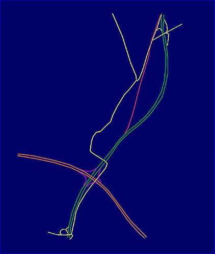 11091 B / 422 x 500 / nov-1.jpg